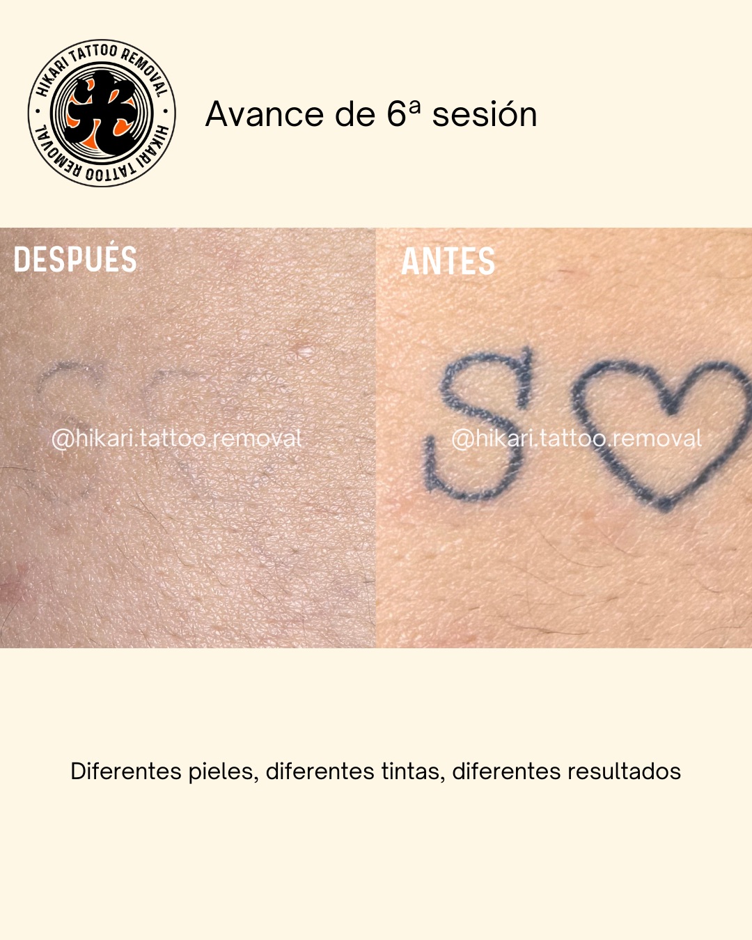 Antes y Después 1