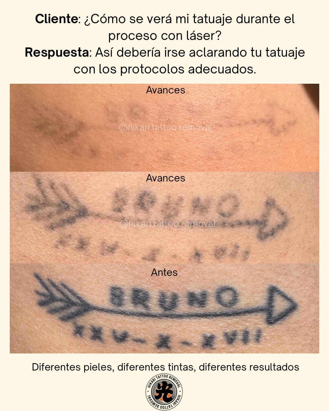 Antes y Después 2