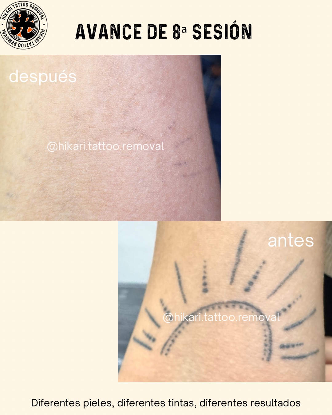 Antes y Después 3