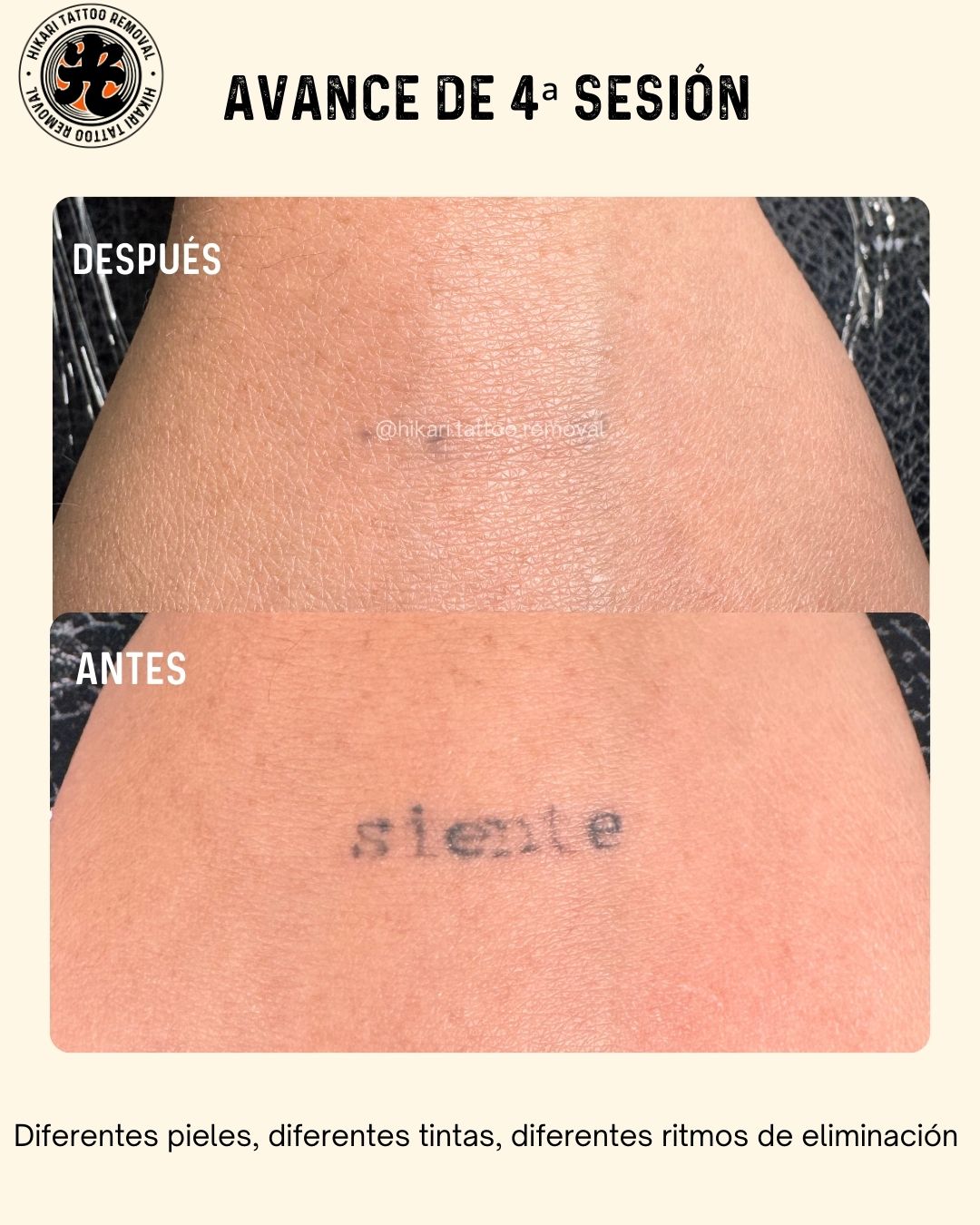 Antes y Después 4