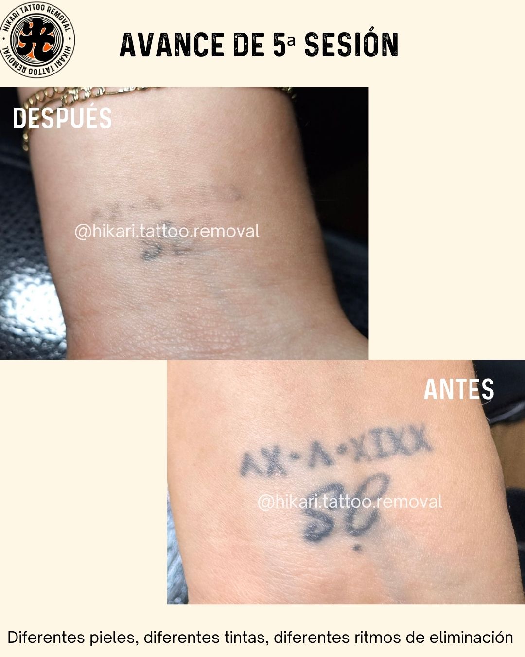 Antes y Después 5