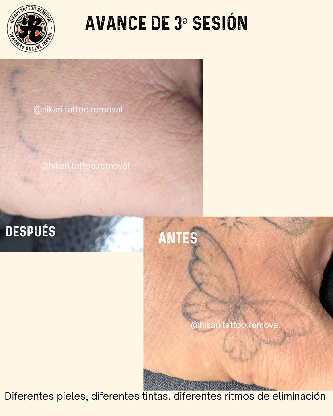 Antes y Después 6