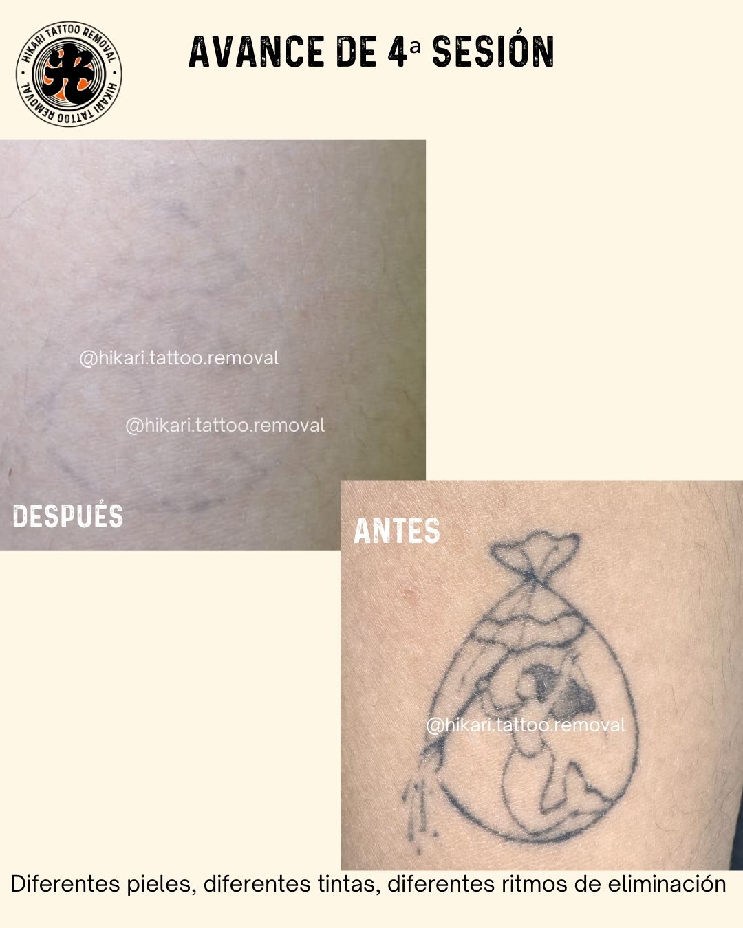 Antes y Después 8